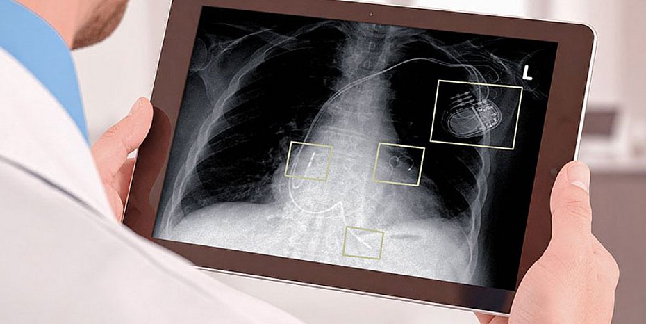 Platinum coating Medical technology Platinum electrolyte